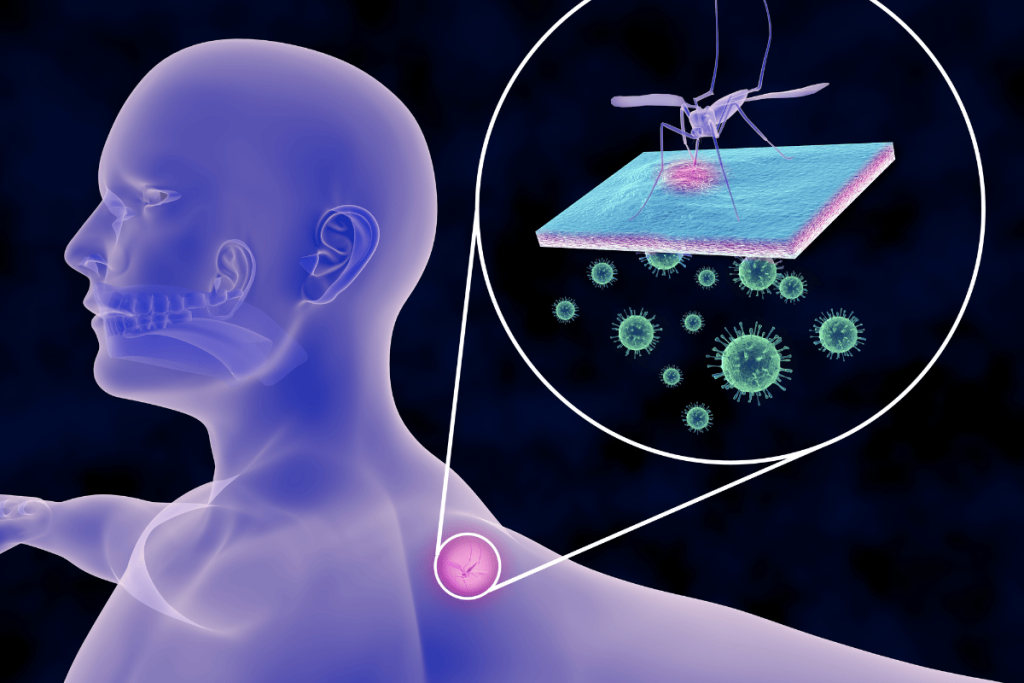 4 bệnh nguy hiểm do muỗi gây ra tại Việt Nam