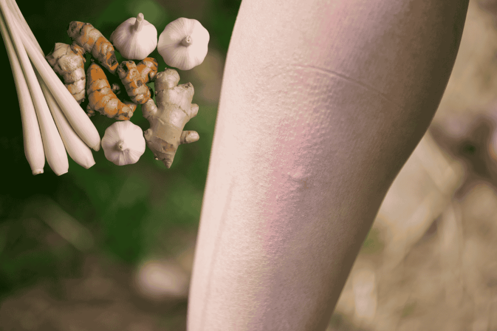 Muỗi đốt bôi gì nhanh khỏi bằng mẹo dân gian